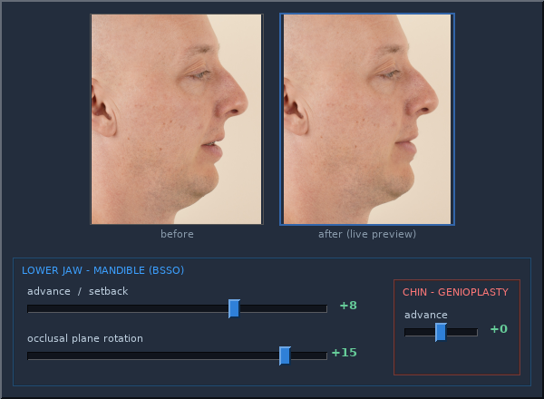 The adjustment interface: live face preview above anatomy sliders