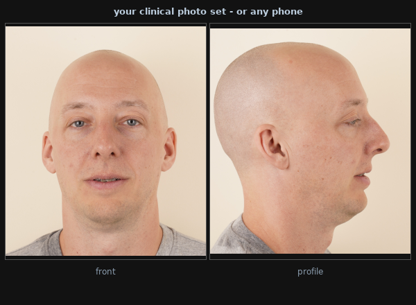 Example input photos: front and profile consult photographs