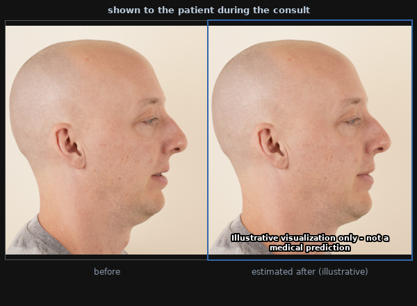 The result shown to the patient: before photo next to the illustrative estimated after