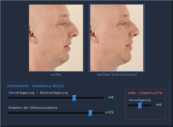 Die Einstelloberfläche: Live-Gesichtsvorschau über den anatomischen Reglern