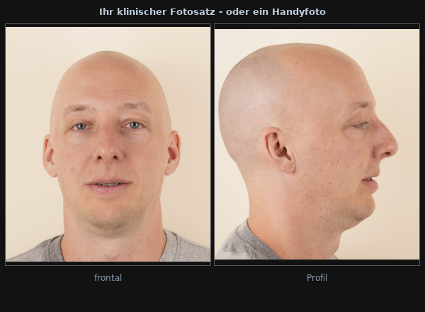 Beispiele für Eingangsfotos: Frontal- und Profilaufnahmen aus der Beratung