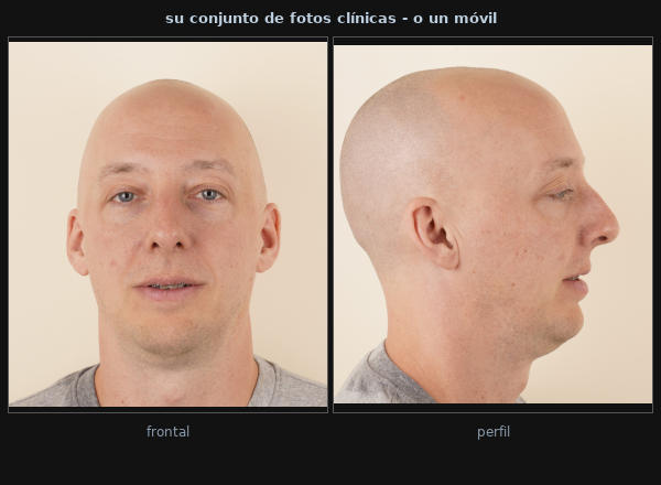 Ejemplos de fotografías de entrada: fotografías de consulta frontal y de perfil
