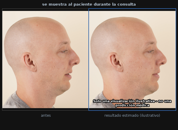 El resultado mostrado al paciente: fotografía inicial junto al después estimado ilustrativo