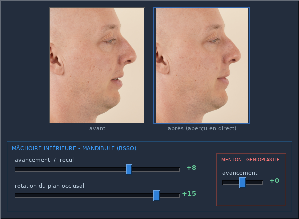L'interface d'ajustement : aperçu du visage en direct au-dessus des curseurs anatomiques
