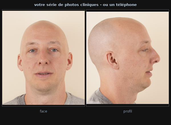 Exemples de photographies d'entrée : photographies de consultation de face et de profil