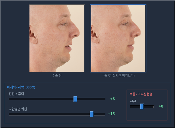 조정 화면: 해부학 슬라이더 위에 놓인 실시간 얼굴 미리보기