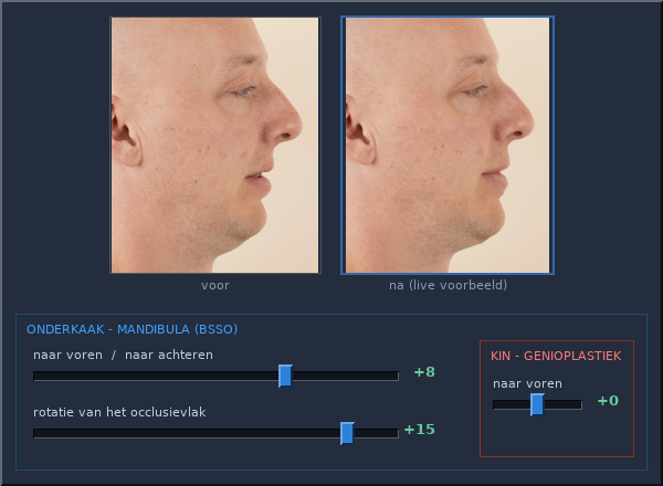 De instelinterface: live gezichtspreview boven de anatomische schuifregelaars