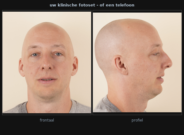 Voorbeelden van invoerfoto's: frontale en profielfoto's uit het consult