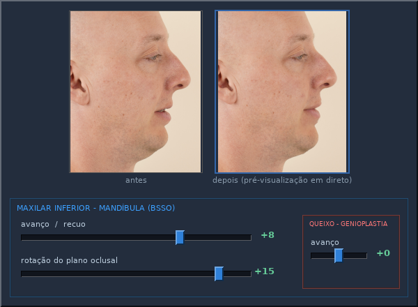 A interface de ajuste: pré-visualização do rosto ao vivo acima dos sliders anatómicos